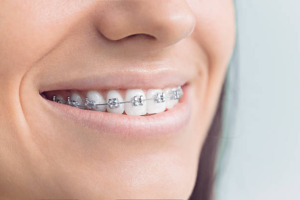 Professional Holistic Dental Care Services in Bridgeton, MO
